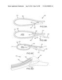 CARDIAC ABLATION SYSTEMS AND METHODS diagram and image