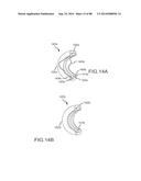 CARDIAC ABLATION SYSTEMS AND METHODS diagram and image