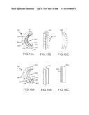 CARDIAC ABLATION SYSTEMS AND METHODS diagram and image