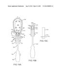 CARDIAC ABLATION SYSTEMS AND METHODS diagram and image