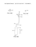 CARDIAC ABLATION SYSTEMS AND METHODS diagram and image