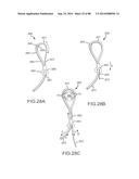 CARDIAC ABLATION SYSTEMS AND METHODS diagram and image