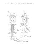 CARDIAC ABLATION SYSTEMS AND METHODS diagram and image