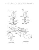 CARDIAC ABLATION SYSTEMS AND METHODS diagram and image