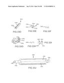 CARDIAC ABLATION SYSTEMS AND METHODS diagram and image