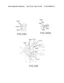 CARDIAC ABLATION SYSTEMS AND METHODS diagram and image