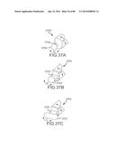 CARDIAC ABLATION SYSTEMS AND METHODS diagram and image