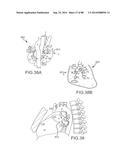 CARDIAC ABLATION SYSTEMS AND METHODS diagram and image