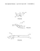 CARDIAC ABLATION SYSTEMS AND METHODS diagram and image