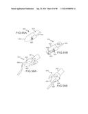 CARDIAC ABLATION SYSTEMS AND METHODS diagram and image