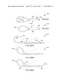 CARDIAC ABLATION SYSTEMS AND METHODS diagram and image