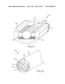 CARDIAC ABLATION SYSTEMS AND METHODS diagram and image