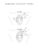 CARDIAC ABLATION SYSTEMS AND METHODS diagram and image