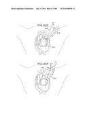 CARDIAC ABLATION SYSTEMS AND METHODS diagram and image