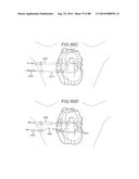 CARDIAC ABLATION SYSTEMS AND METHODS diagram and image