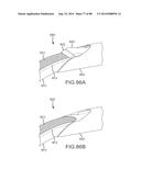 CARDIAC ABLATION SYSTEMS AND METHODS diagram and image