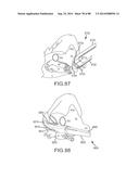 CARDIAC ABLATION SYSTEMS AND METHODS diagram and image