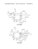 CARDIAC ABLATION SYSTEMS AND METHODS diagram and image