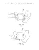 CARDIAC ABLATION SYSTEMS AND METHODS diagram and image