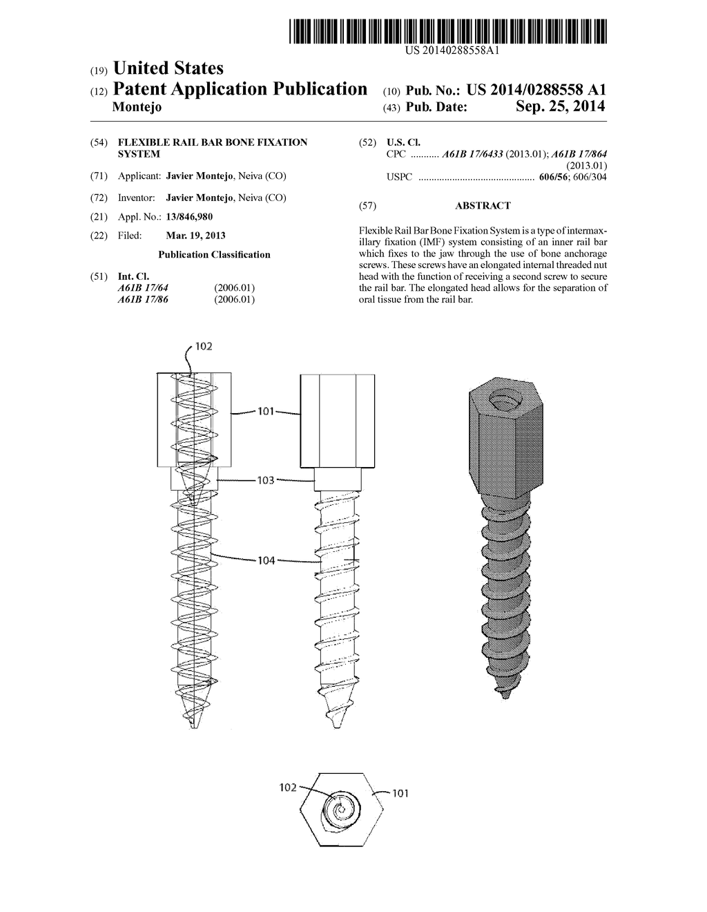 Flexible Rail Bar Bone Fixation System - diagram, schematic, and image 01