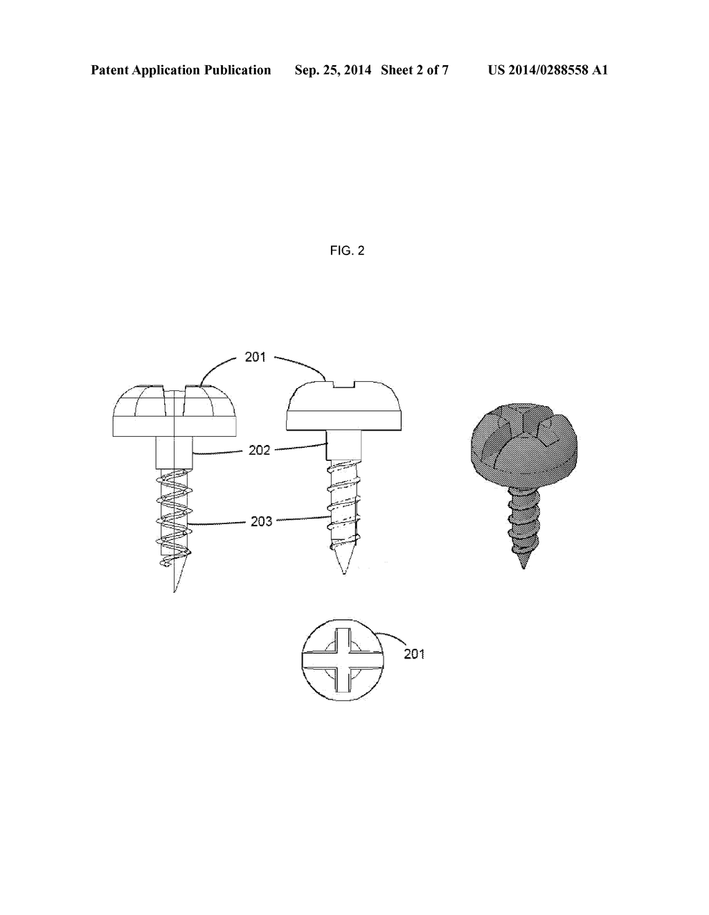 Flexible Rail Bar Bone Fixation System - diagram, schematic, and image 03