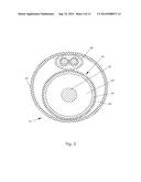 METHOD AND SYSTEM FOR DESTROYING OF UNDESIRABLE FORMATIONS IN MAMMALIAN     BODY diagram and image