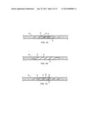 Apparatus and Methods for Treating Hardened Vascular Lessions diagram and image