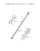 Apparatus and Methods for Treating Hardened Vascular Lessions diagram and image