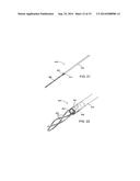 Apparatus and Methods for Treating Hardened Vascular Lessions diagram and image