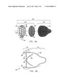 Intravascular Filter With Debris Entrapment Mechanism diagram and image