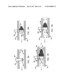 Intravascular Filter With Debris Entrapment Mechanism diagram and image