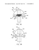 Intravascular Filter With Debris Entrapment Mechanism diagram and image