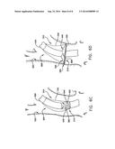 Intravascular Filter With Debris Entrapment Mechanism diagram and image