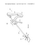 TACK ANCHOR SYSTEMS, BONE ANCHOR SYSTEMS, AND METHODS OF USE diagram and image