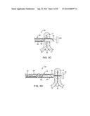 APPARATUS AND METHODS FOR POSITIONING AND SECURING ANCHORS diagram and image