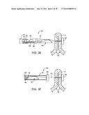 APPARATUS AND METHODS FOR POSITIONING AND SECURING ANCHORS diagram and image