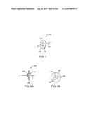 APPARATUS AND METHODS FOR POSITIONING AND SECURING ANCHORS diagram and image