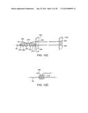 APPARATUS AND METHODS FOR POSITIONING AND SECURING ANCHORS diagram and image