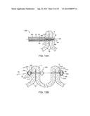 APPARATUS AND METHODS FOR POSITIONING AND SECURING ANCHORS diagram and image