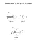 APPARATUS AND METHODS FOR POSITIONING AND SECURING ANCHORS diagram and image