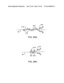 APPARATUS AND METHODS FOR POSITIONING AND SECURING ANCHORS diagram and image