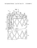 TRIPLE-COLLAR STENT-GRAFT diagram and image