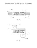 TRAUMATIC BONE FRACTURE REPAIR SYSTEMS AND METHODS diagram and image