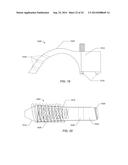 TRAUMATIC BONE FRACTURE REPAIR SYSTEMS AND METHODS diagram and image