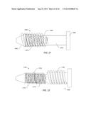 TRAUMATIC BONE FRACTURE REPAIR SYSTEMS AND METHODS diagram and image