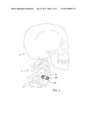 CONTINUOUS PHASE COMPOSITE FOR MUSCULOSKELETAL REPAIR diagram and image