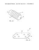 CONTINUOUS PHASE COMPOSITE FOR MUSCULOSKELETAL REPAIR diagram and image