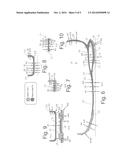 SOLE ASSEMBLY FOR ARTICLE OF FOOTWEAR diagram and image