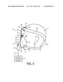 PATIENT INTERFACE DEVICE WITH NOSE BRIDGE  ADJUSTMENT diagram and image