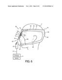 PATIENT INTERFACE DEVICE WITH NOSE BRIDGE  ADJUSTMENT diagram and image